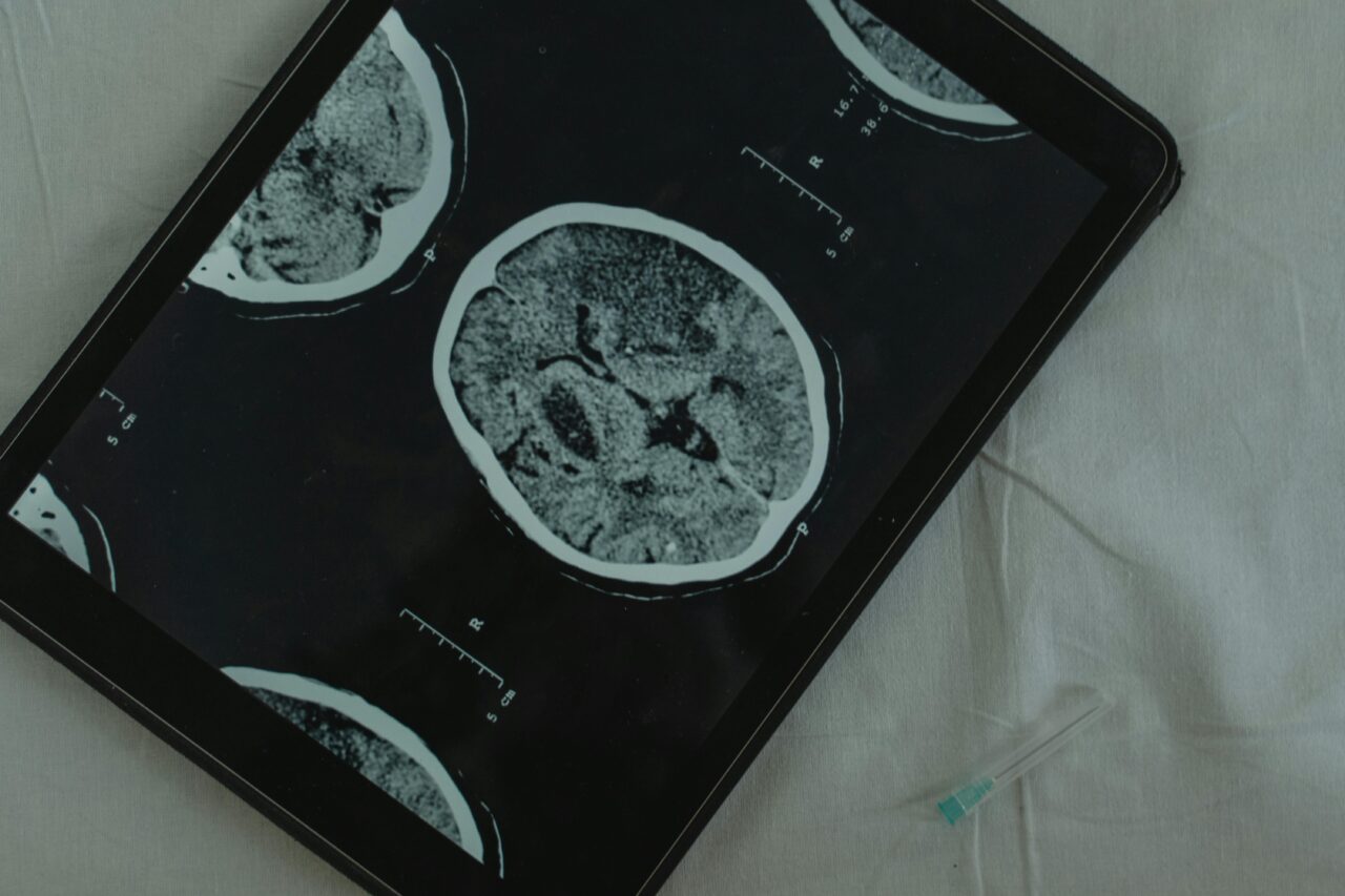 Vor allem in bildgebenden Verfahren kommt KI (künstliche Intelligenz) in der Medizin zum Einsatz.